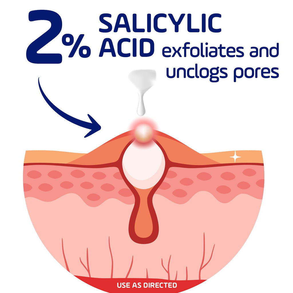 Asepxia 2% Salicylic Acid Acne Spot Treatment Cream for Rapid Breakout Control