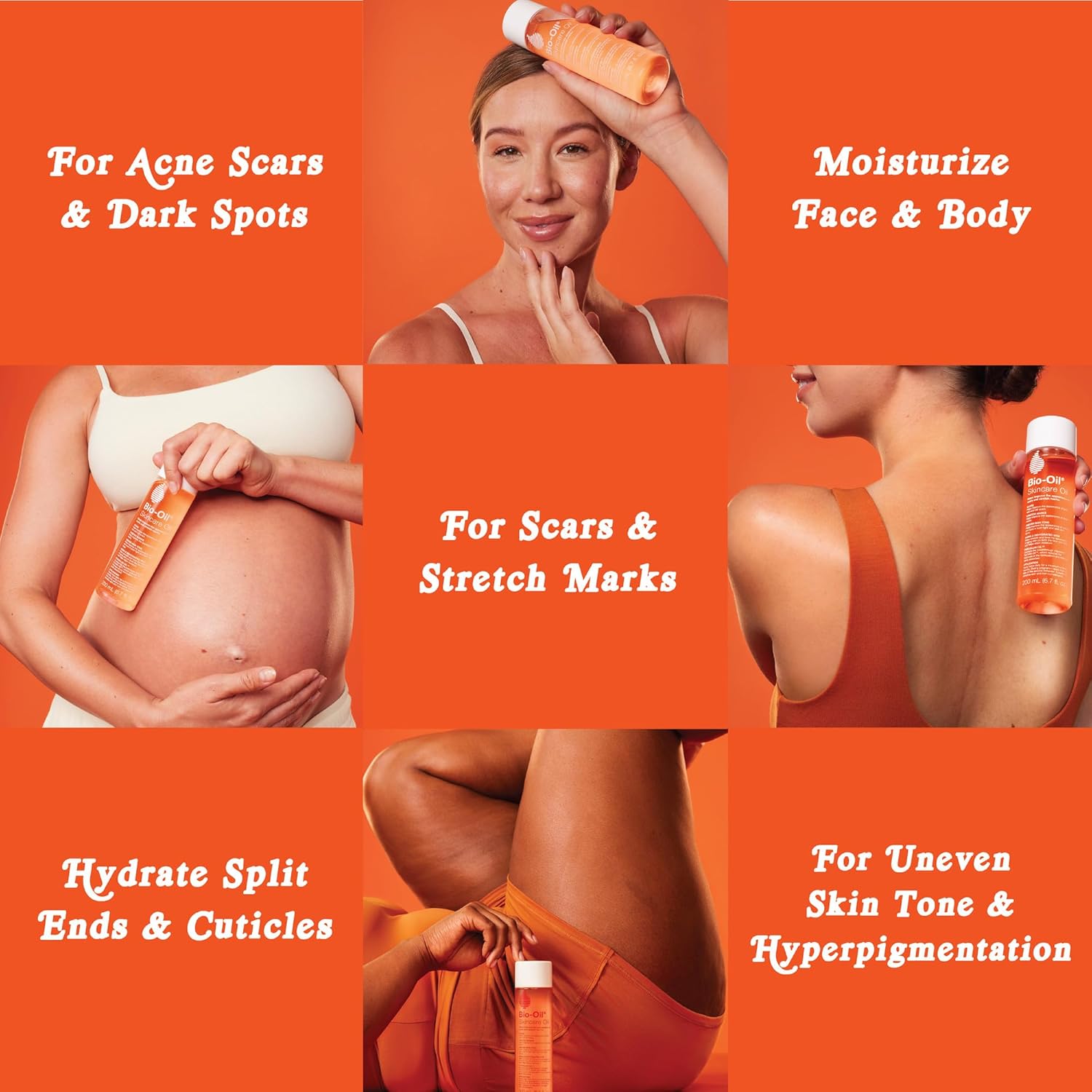 Bio-Oil Body Oil Serum for Scars & Stretch Marks - Vitamin E, Natural Oils, 2 Oz