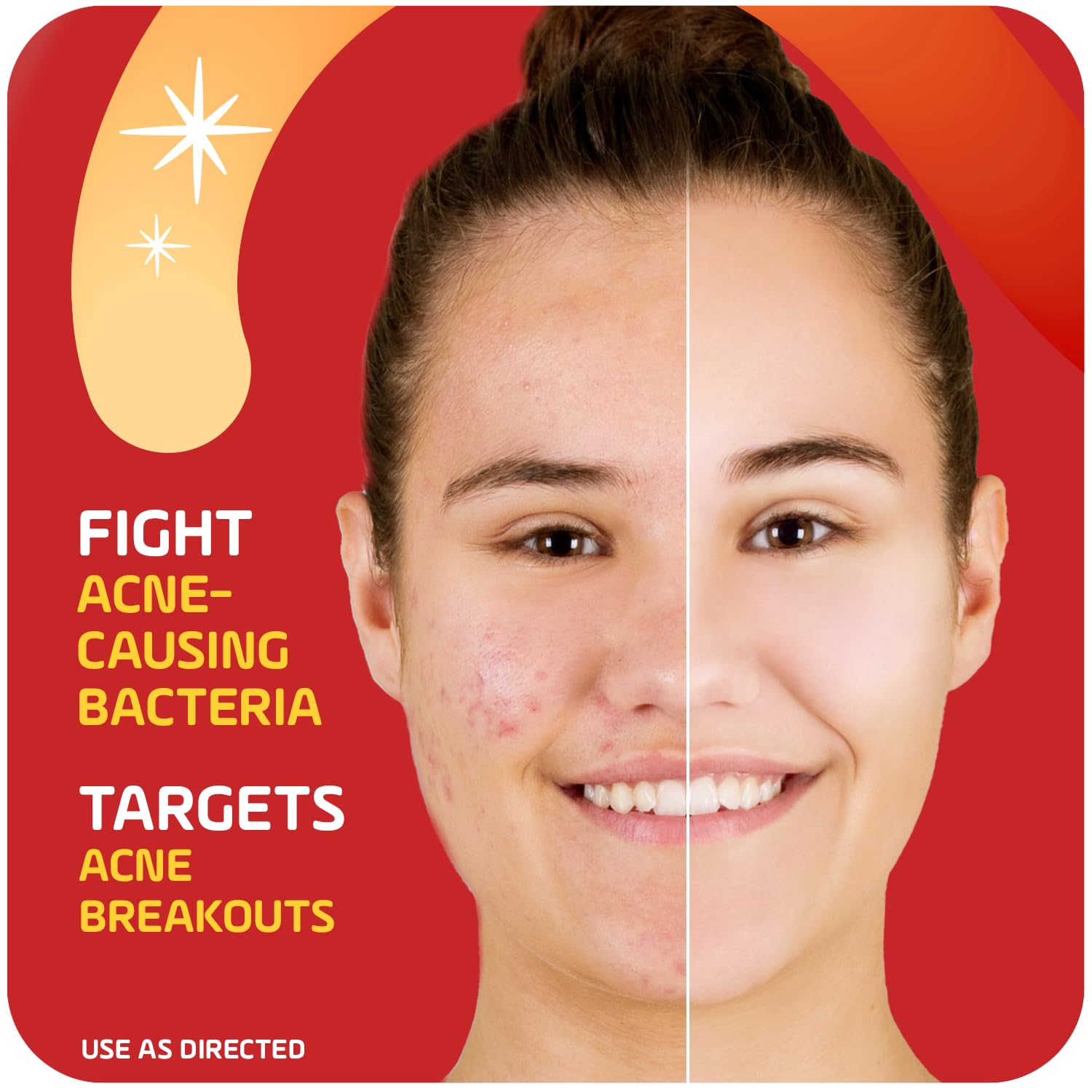 Asepxia 2% Salicylic Acid Acne Spot Treatment Cream for Rapid Breakout Control