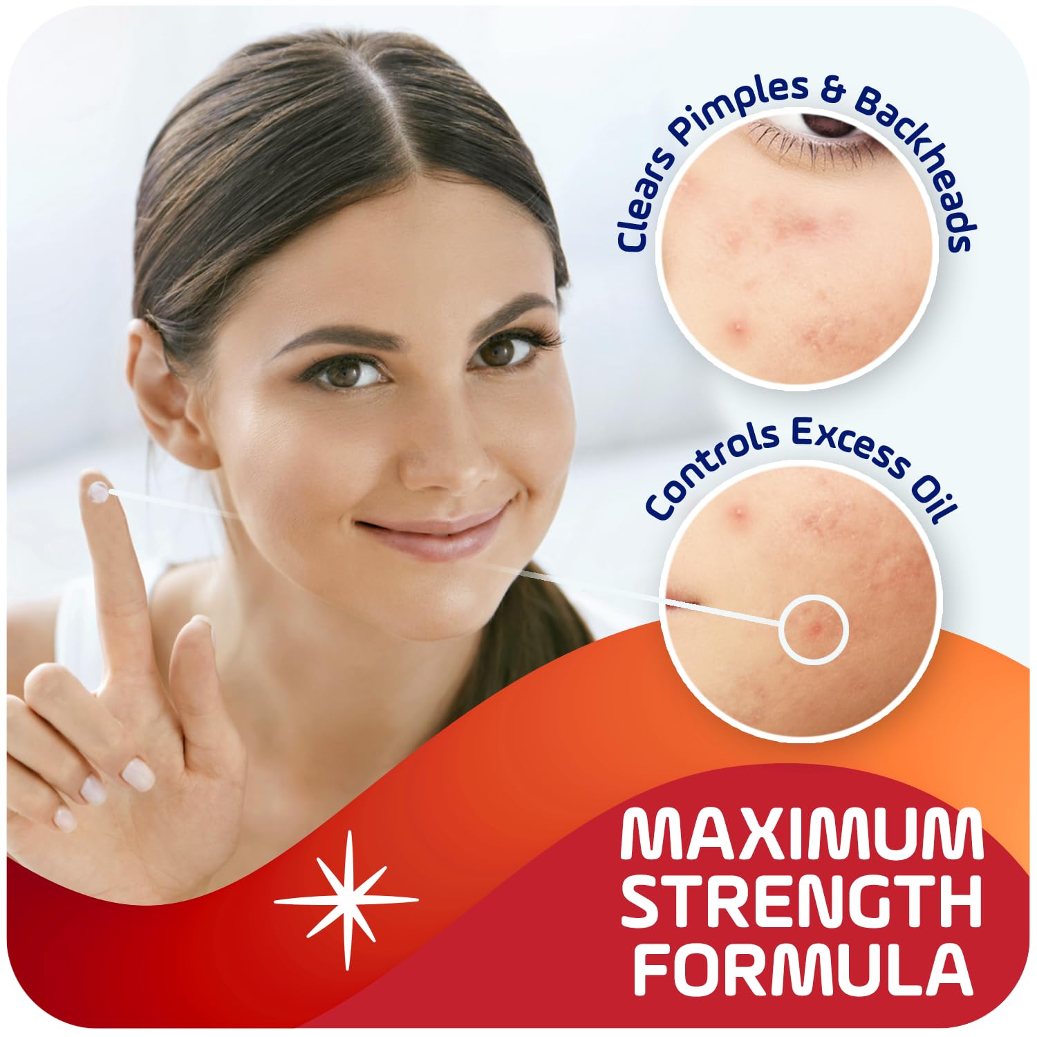 Asepxia 2% Salicylic Acid Acne Spot Treatment Cream for Rapid Breakout Control