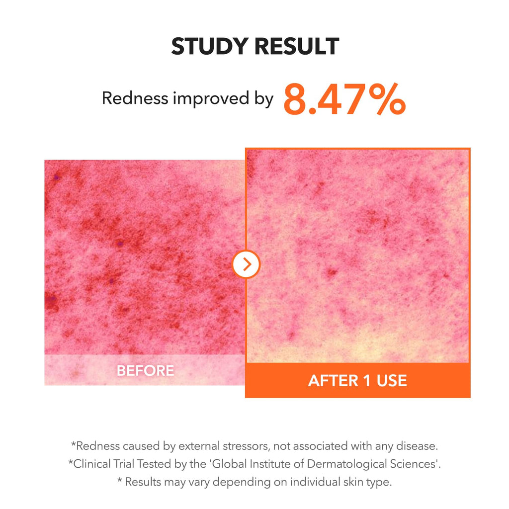 Soothe & Clear Acne with APRILSKIN Carrotene IPMP Solution - BHA/AHA/Niacinamide, 0.67 fl oz