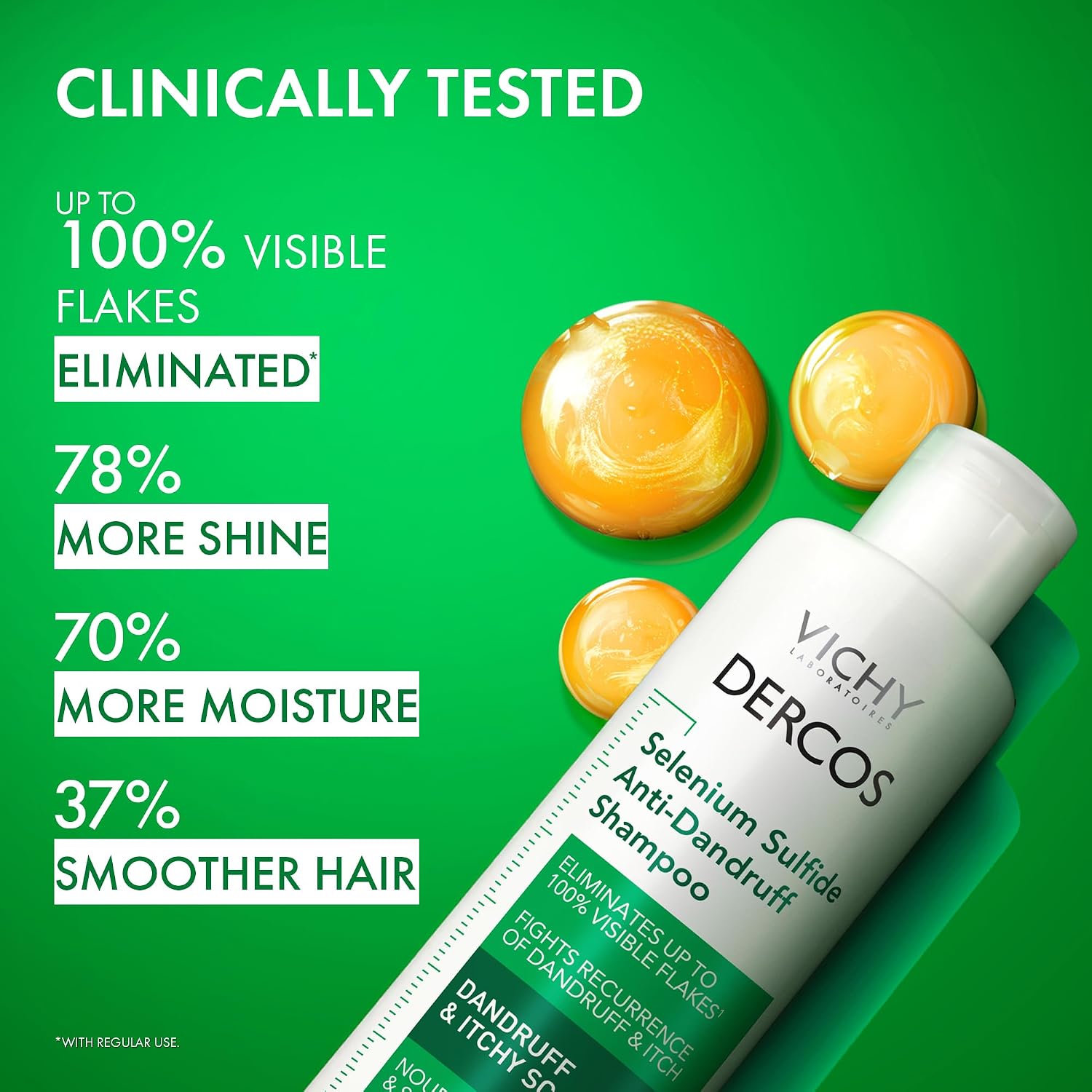 Vichy Dercos Antifungal Dandruff Shampoo for Itchy Scalp - 200ml