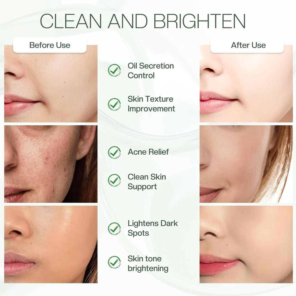 Jtopyrt 20% Glycolic Acid Pads - Dual-Sided Exfoliating Face Peels for Acne & Fine Lines, 60 Count