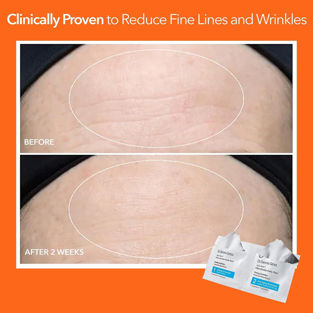 Dr. Dennis Gross Alpha Beta Ultra Gentle Daily Peel Pads for Dehydrated/Sensitive Skin (5 Treatments)