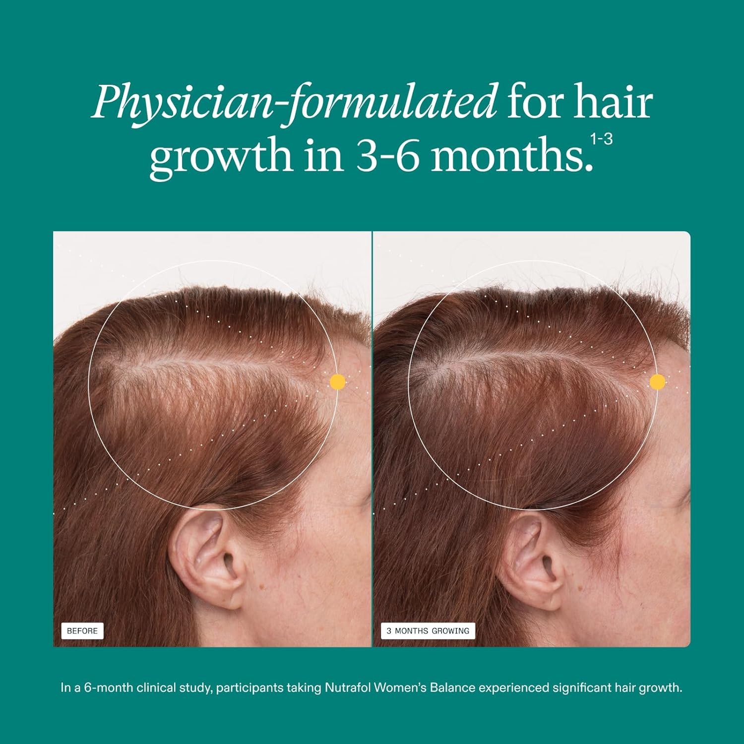 Nutrafol Women's Balance Hair Growth Supplements for Thinning Hair in 45+ Women-4-Capsule Daily Dose