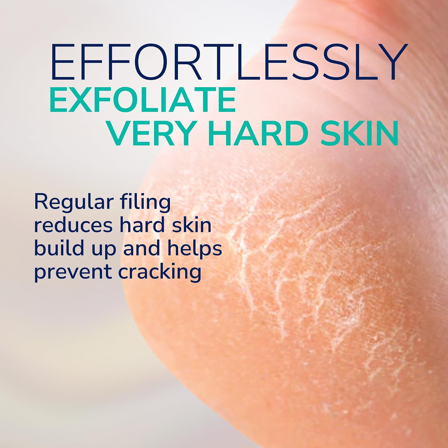 Dr. Scholl's Electric Foot File - Remove Tough Calluses Fast for Soft Smooth Skin