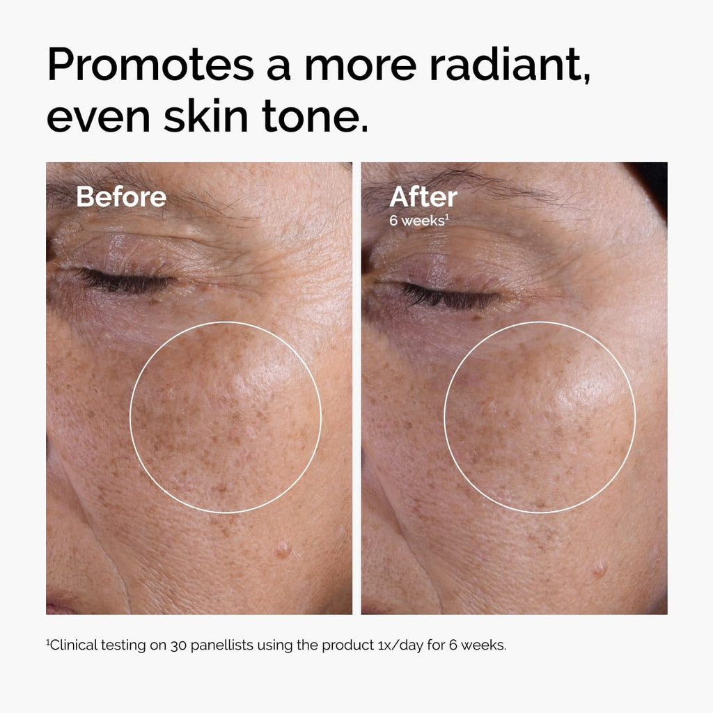 The Ordinary 7% Glycolic Acid Exfoliating Toner for Even Skin Tone & Radiance