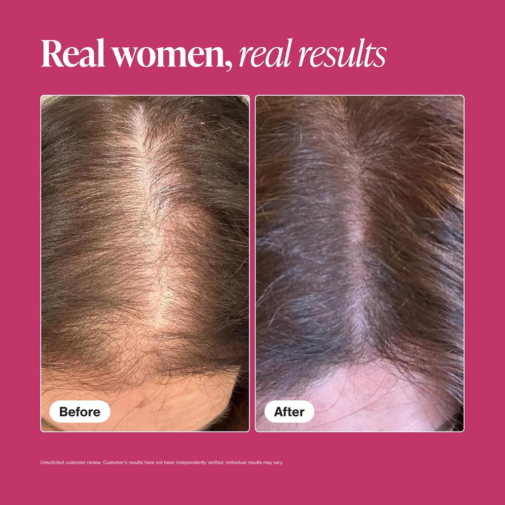 Viviscal Hair Growth Supplements for Women - Proprietary Collagen Complex, 60 Tablets