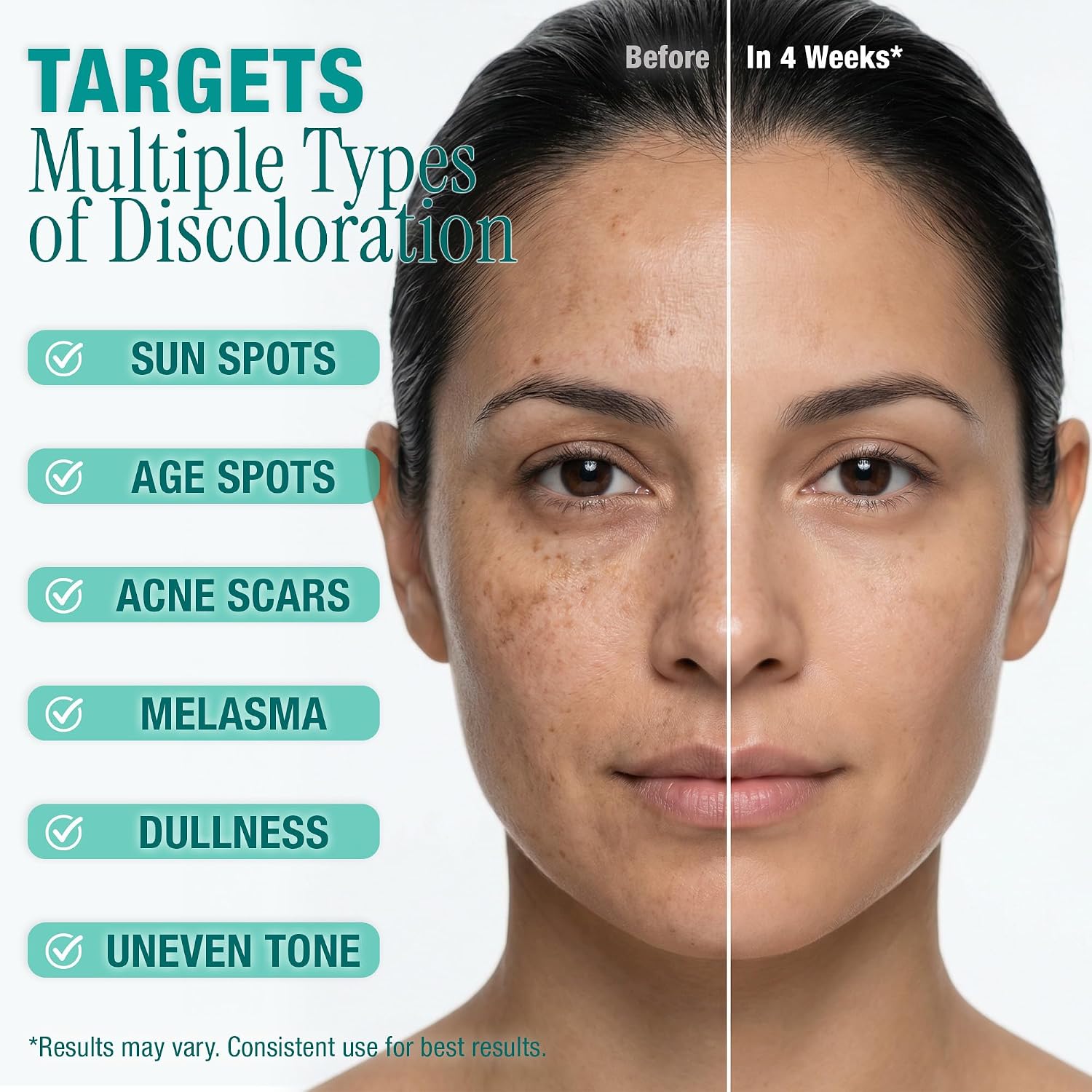Ebanel Dark Spot Remover Serum with Synovea HR & Multi-Acids for Face & Body - Visible Brightening in 4 Weeks