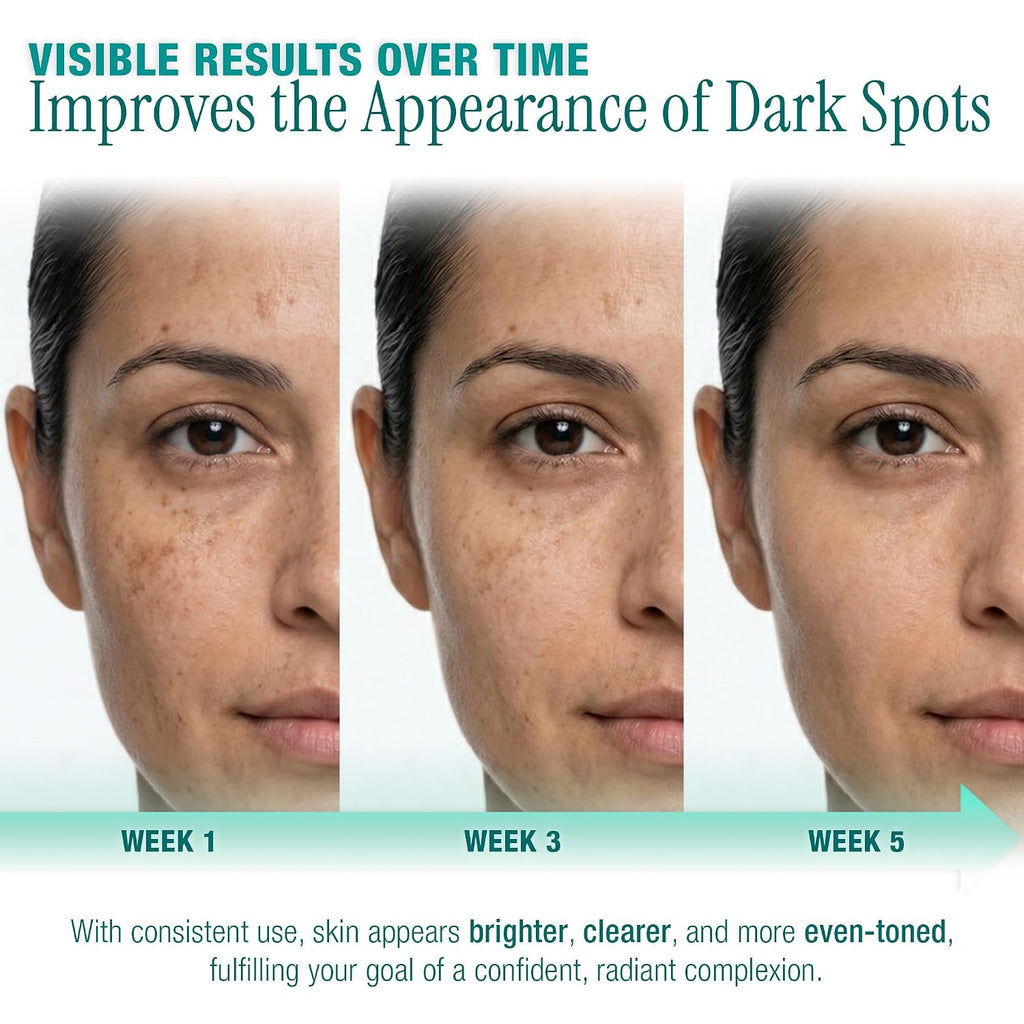 Ebanel Dark Spot Remover Serum with Synovea HR & Multi-Acids for Face & Body - Visible Brightening in 4 Weeks
