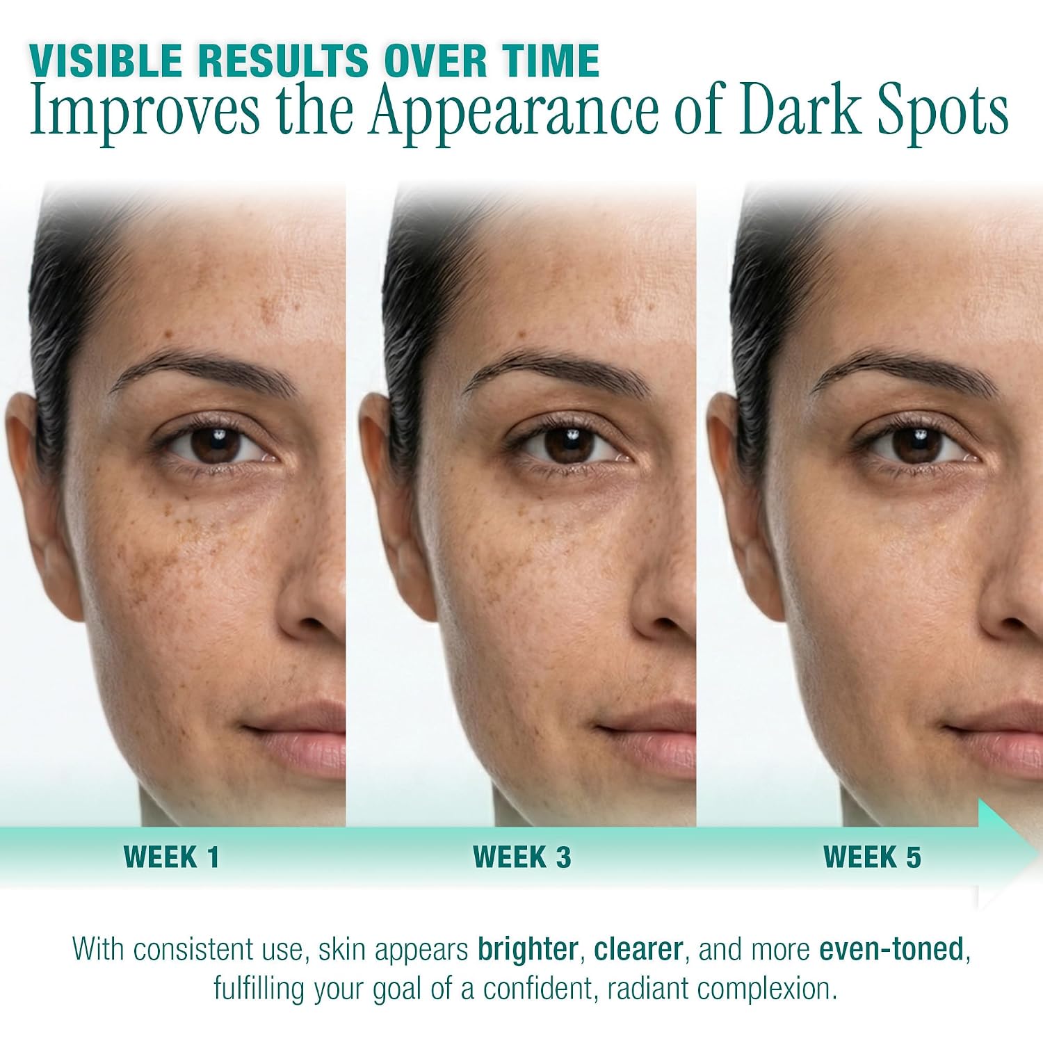 Ebanel Dark Spot Remover Serum with Synovea HR & Multi-Acids for Face & Body - Visible Brightening in 4 Weeks