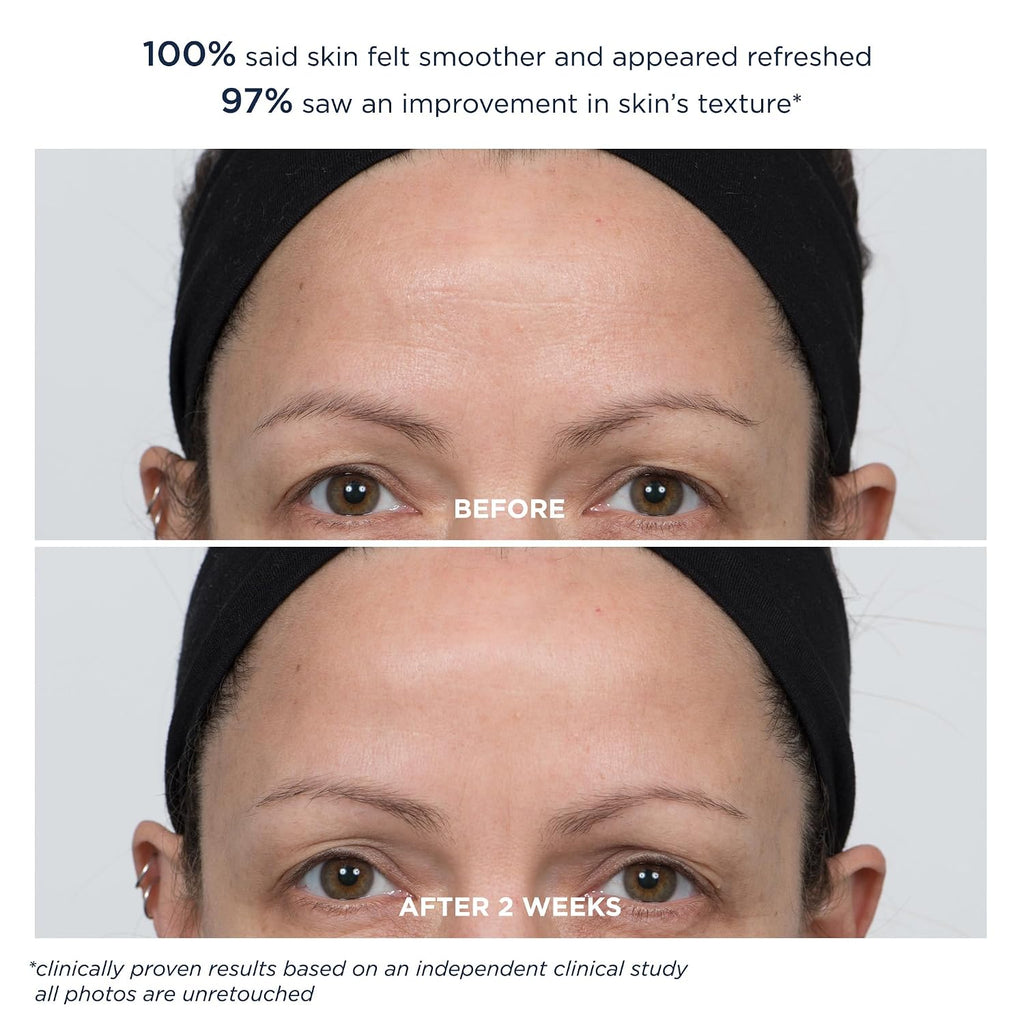 m-61 PowerGlow 20% Glycolic Acid Overnight Facial Peel - Professional Strength Exfoliating Pad