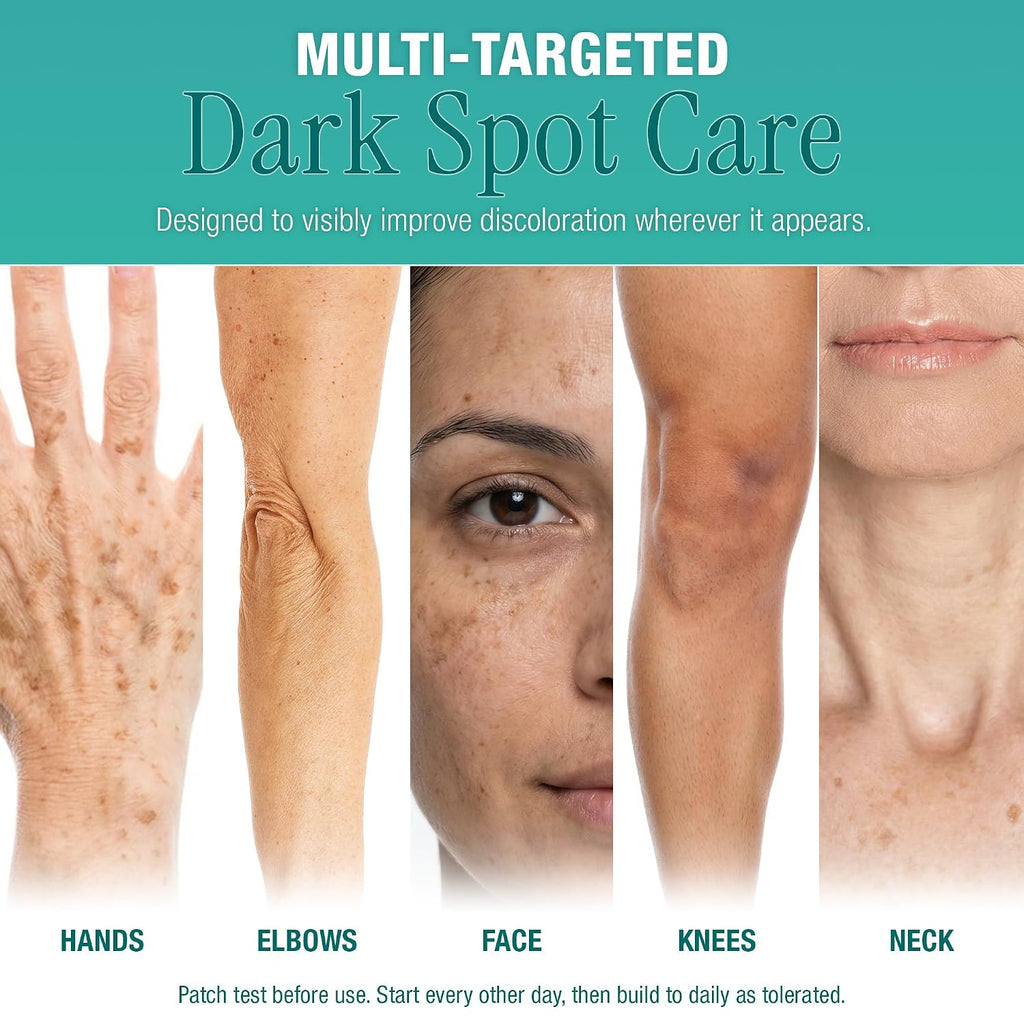 Ebanel Dark Spot Remover Serum with Synovea HR & Multi-Acids for Face & Body - Visible Brightening in 4 Weeks