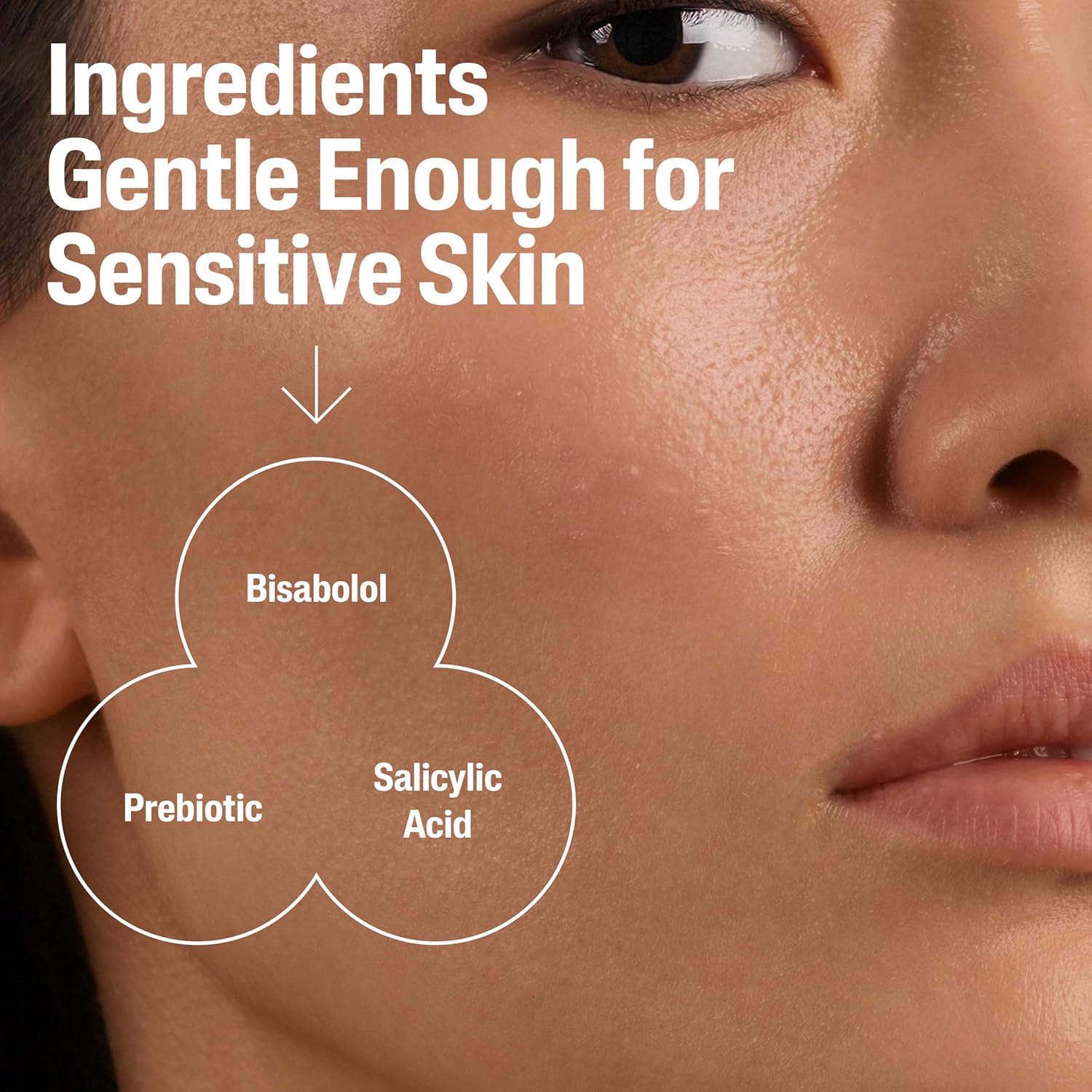 Cetaphil Gentle Acne Moisturizer with 0.5% Salicylic Acid for Sensitive Skin, 3oz