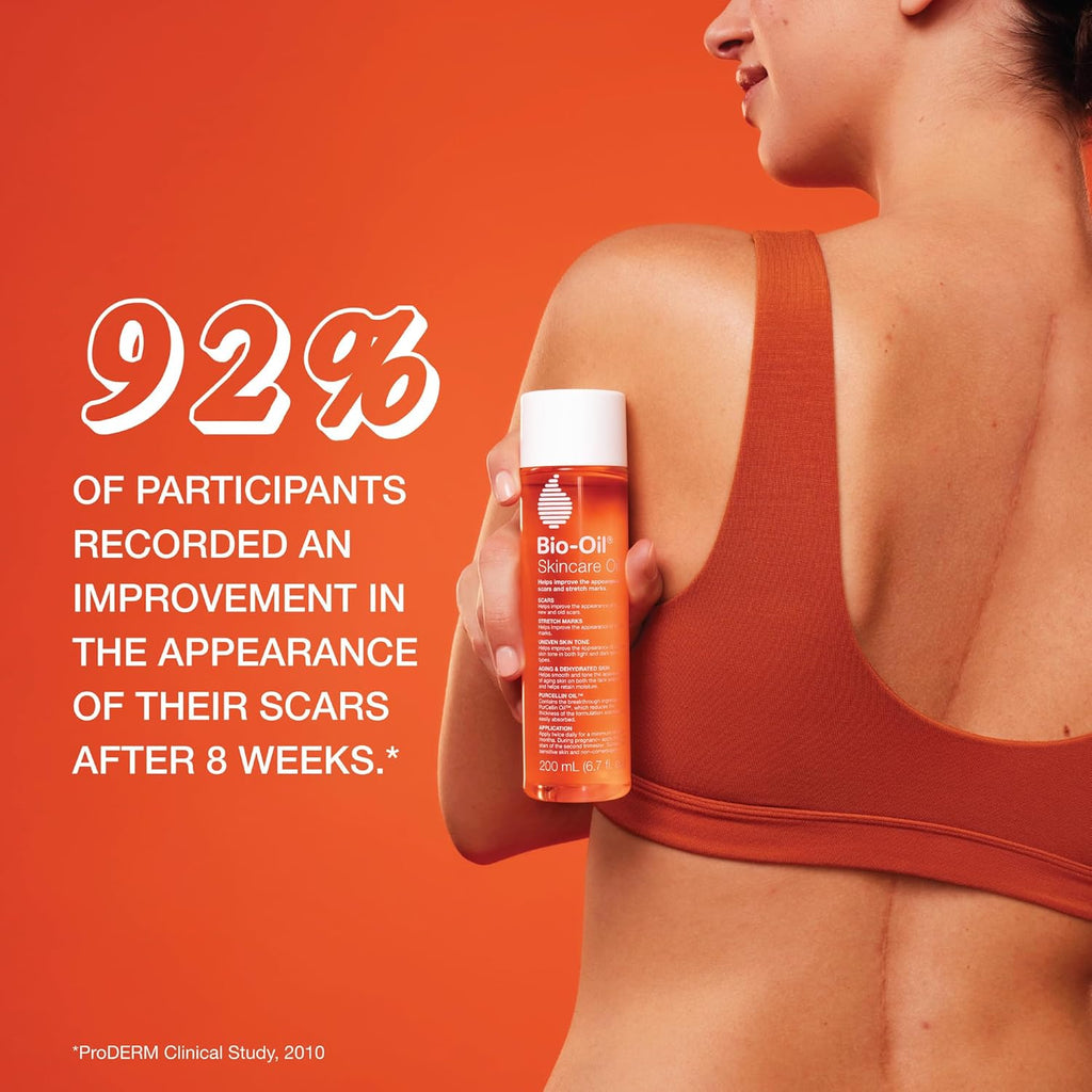 Bio-Oil Body Oil Serum for Scars & Stretch Marks - Vitamin E, Natural Oils, 2 Oz