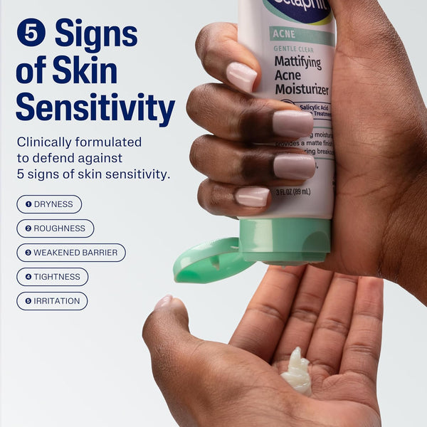 Cetaphil Gentle Acne Moisturizer with 0.5% Salicylic Acid for Sensitive Skin, 3oz