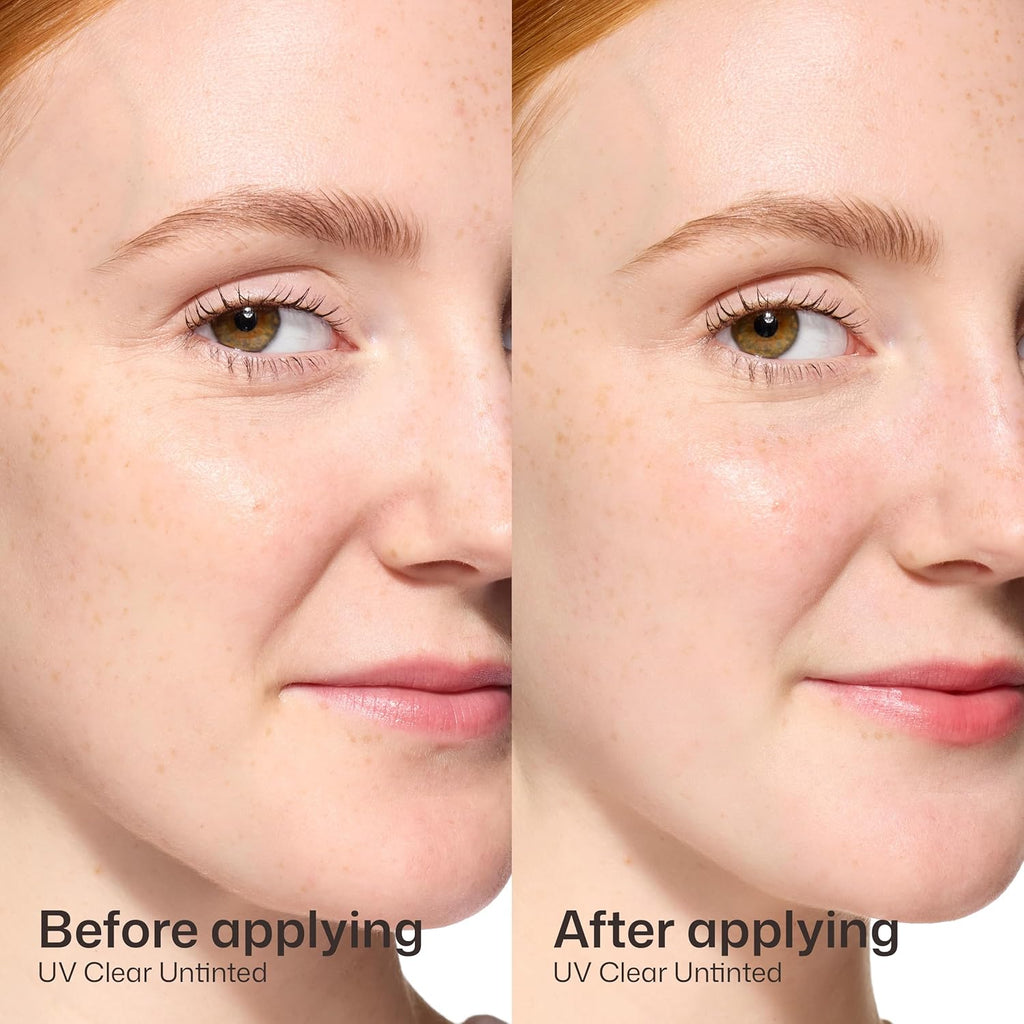 EltaMD UV Clear Face Sunscreen SPF 46 - Oil-Free Zinc Oxide Sunscreen for Sensitive Skin