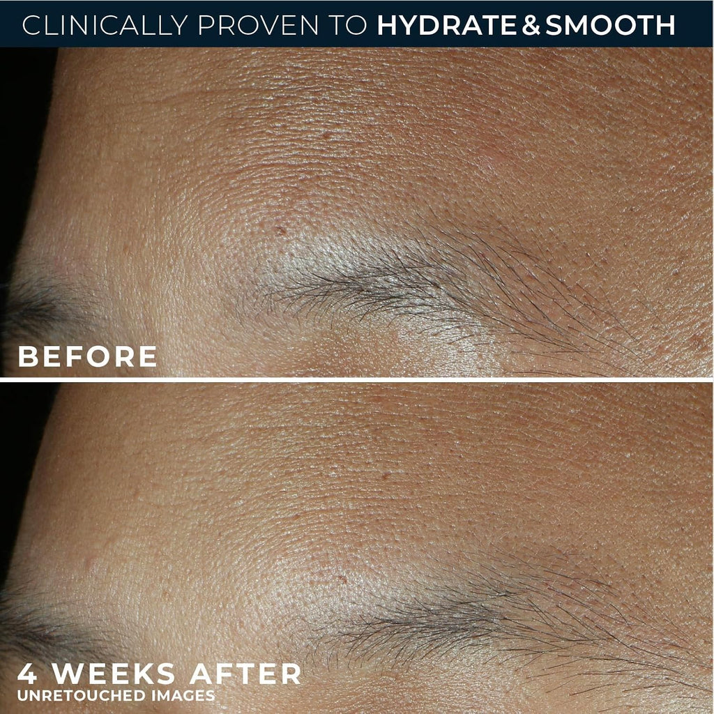 RoC Retinol Correxion Max Hydration Anti-Aging Face Cream - Fragrance-Free & Oil-Free Moisturizer for Wrinkles & Dry Skin
