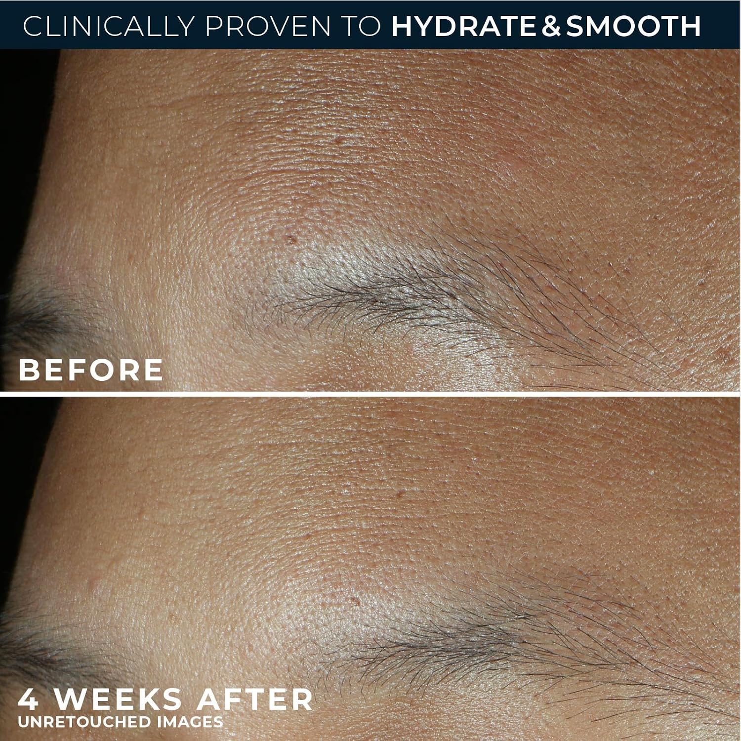 RoC Retinol Correxion Max Hydration Anti-Aging Face Cream - Fragrance-Free & Oil-Free Moisturizer for Wrinkles & Dry Skin