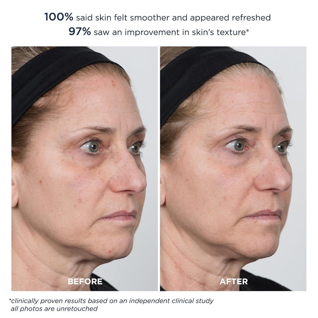 m-61 PowerGlow 20% Glycolic Acid Overnight Facial Peel - Professional Strength Exfoliating Pad