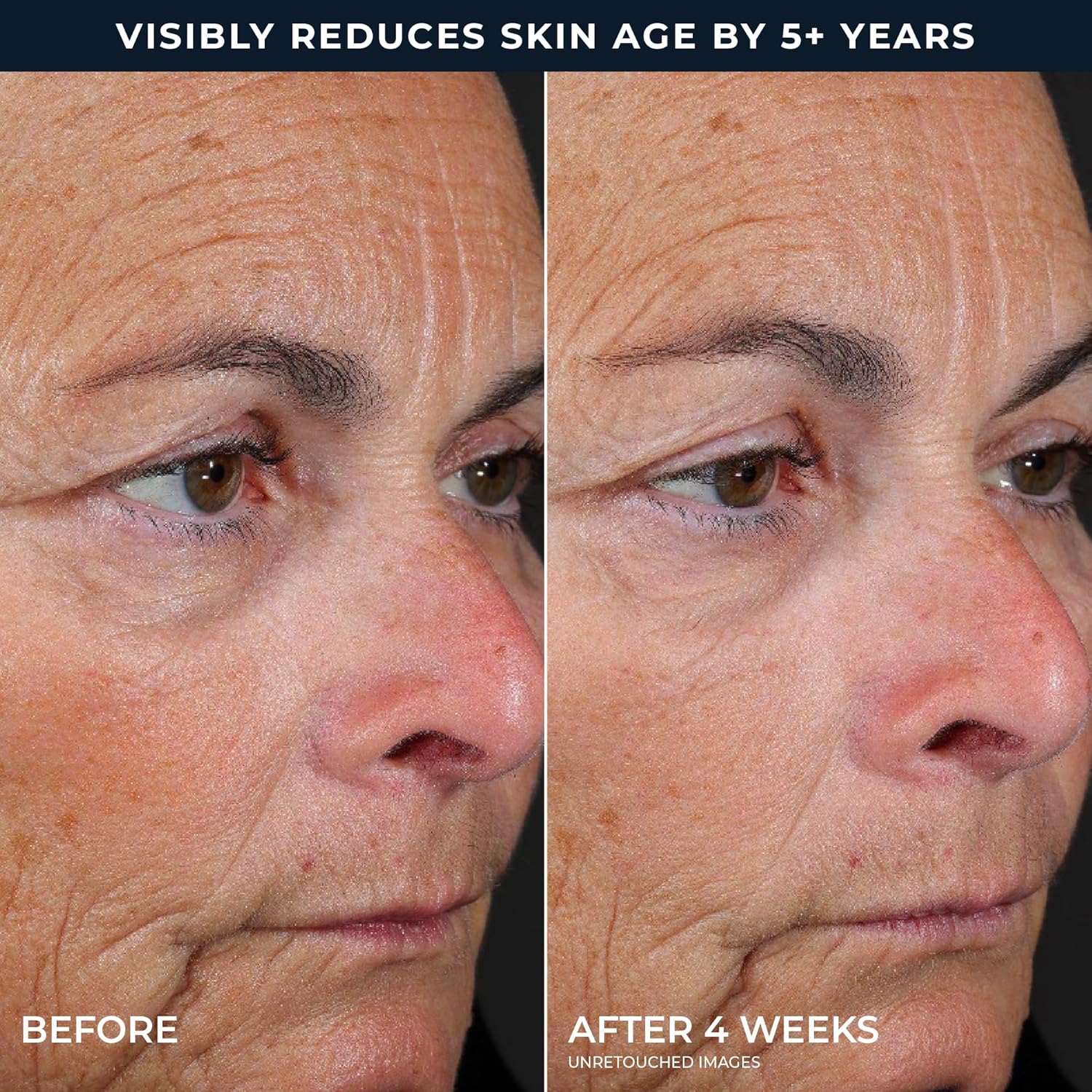 RoC Retinol Correxion Line Smoothing 2-Step Peel Pads - Clinical Retinol & 5-Acid Blend for Fine Lines & Dull Skin, 20 Treatments