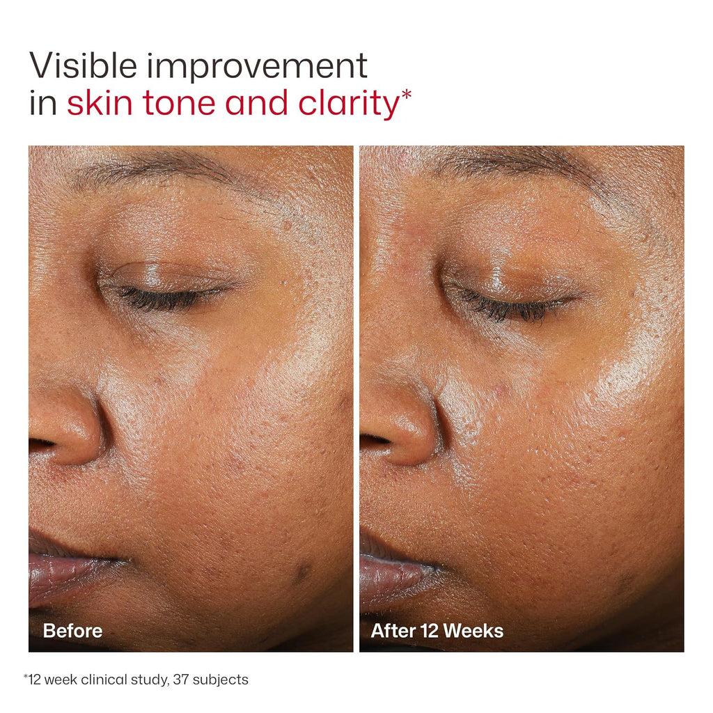 EltaMD UV Clear Face Sunscreen SPF 46 - Oil-Free Zinc Oxide Sunscreen for Sensitive Skin